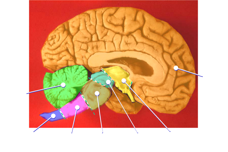 Midsagittal section of a human brain, showing the pineal gland in the epithalamus